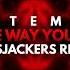 Artemas I Like The Way You Kiss Me Bassjackers Remix