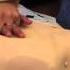 Defibrillator
