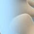 Epley Maneuver To Treat BPPV Vertigo