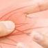 Tingling Sensation Try These Tricks To Stop Pins And Needles Instantly