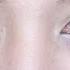Bigger Brighter Looking Eyes With Aegyo Sal