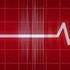 Heart Monitor Failure Flatline Sound Effect