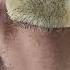 충격 쾌감 수염왁싱 Face Hair Removal Beard Waxing Shorts