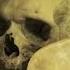 Donetsk Morgue Overrun With Civilian Casualties Russian Roulette Dispatch 74