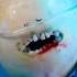 Coconut Ate Taylor Swifts Cardigan EmergencySurgery DiscountDentist Ep244 FruitSurgery Shorts