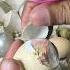 Stop Peeling An Egg With Blood Veins Shorts
