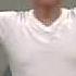Thoracic Outlet Syndrome Patient With A Positive ROOS Test