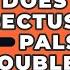 Does Lateral Rectus Muscle Palsy Cause Double Vision Optometry Knowledge Base