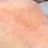 Male Chest Waxing With Strip Less Wax Also Great For Male Brazilian Waxing At Alexspot24 NYC