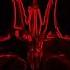 Live Visuals VJ Set Tripart Radiated Art DJ Set Fabio Panaro Techno Keller Vol 03