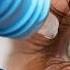 Reverse Cataracts Naturally NAC Eye Drops Explained