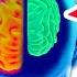 1 Absolute Best Way To Reverse Slow Dementia