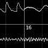 Sparta Gamma V4 Base Oscilloscope View